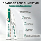 Acne Spot Treatment Pen Rapid Pimple Treatment for Clear Skin OEM Private Label