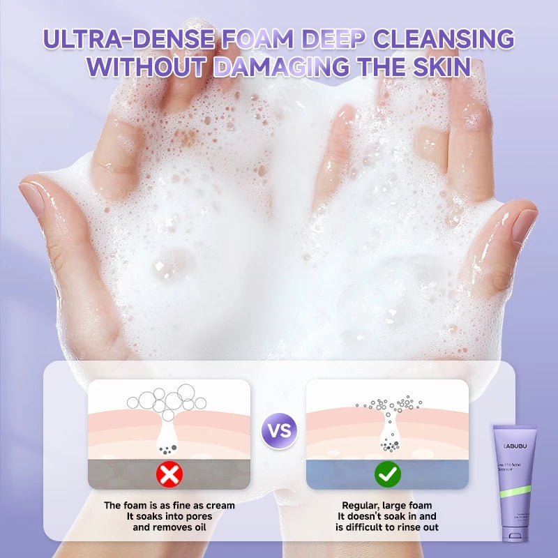LABUBU Facial Wash Low PH Acne Cleanser Sabun muka 100 gram Untuk Kulit Sensitif