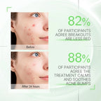Acne Spot Treatment Serum 10ml Overnight Pimple Care, Oil Control Blemish Relief