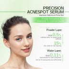 Acne Spot Treatment Serum 10ml Overnight Pimple Care, Oil Control Blemish Relief